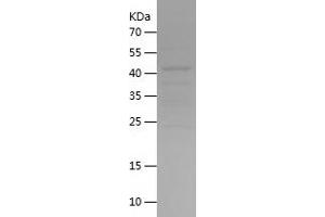 Western Blotting (WB) image for Pituitary Tumor-Transforming 1 (PTTG1) (AA 1-202) protein (His-IF2DI Tag) (ABIN7124456)