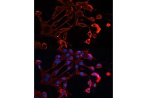 Immunofluorescence analysis of NIH/3T3 cells using  antibody (ABIN7265433) at dilution of 1:100.