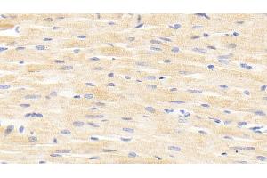 Detection of ANGPTL4 in Rat Cardiac Muscle Tissue using Polyclonal Antibody to Angiopoietin Like Protein 4 (ANGPTL4)