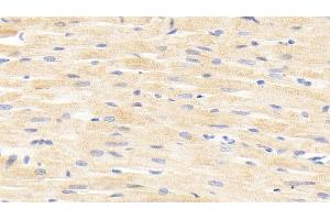 Detection of ANGPTL4 in Rat Cardiac Muscle Tissue using Polyclonal Antibody to Angiopoietin Like Protein 4 (ANGPTL4) (ANGPTL4 anticorps  (AA 182-394))