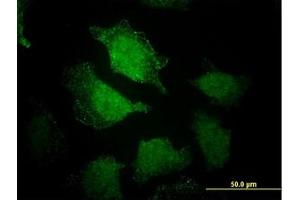 Image no. 5 for anti-EH-Domain Containing 3 (EHD3) (AA 357-407) antibody (ABIN599233) (EHD3 anticorps  (AA 357-407))