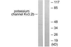 Western blot analysis of extracts from HepG2 cells, using Potassium Channel Kv3. (KCNC2 anticorps)