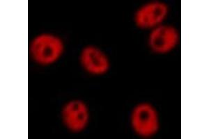 ABIN6268824 staining HT29 by IF/ICC.