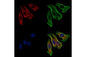 ABIN6257349 and ABIN6274728 staining Hela cells by IF/ICC.