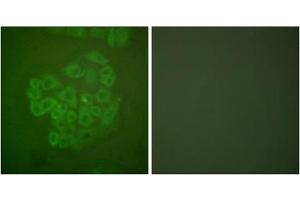 Immunofluorescence analysis of A549 cells, using GR (epitope around residue 211) antibody (ABIN5976159). (GR (Internal Region), (pSer211) anticorps)