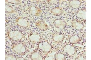 Immunohistochemistry of paraffin-embedded human colon tissue using ABIN7150532 at dilution of 1:100 (DNAJB8 anticorps  (AA 1-232))