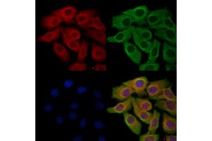 ABIN6265094 and ABIN6278291 staining Hela cells by IF/ICC. (SIRT5 anticorps  (Internal Region))