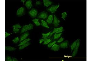 Immunofluorescence of monoclonal antibody to RAB9A on HeLa cell. (RAB9A anticorps  (AA 17-115))