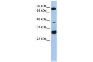 Image no. 1 for anti-Chromosome 1 Open Reading Frame 110 (C1ORF110) (AA 35-84) antibody (ABIN6743881) (C1ORF110 anticorps  (AA 35-84))