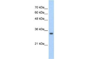 WB Suggested Anti-ZNF227 Antibody Titration:  2. (ZNF227 anticorps  (Middle Region))
