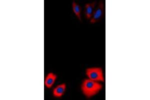 Immunofluorescent analysis of MARK2 staining in Jurkat cells. (MARK2 anticorps  (N-Term))