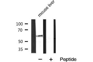 Western blot analysis of extracts of various celllines,using P62/SQSTM1 Antibody.