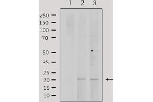 Western blot analysis of extracts from various samples, using PPP1R14C Antibody. (PPP1R14C anticorps  (Internal Region))
