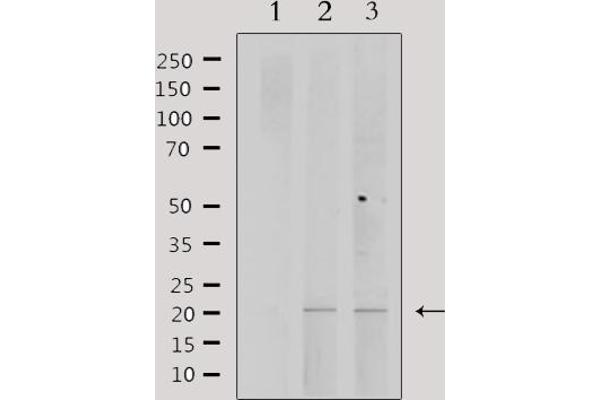PPP1R14C anticorps  (Internal Region)