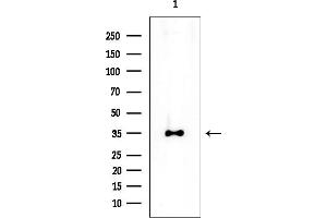 Western blot analysis of lysates from Rat brain, using MDH1 Mouse Monoclonal Antibody at 1/1000 dilution.