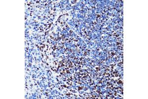 Immunohistochemistry of paraffin-embedded mouse spleen using Acetyl-Histone H2B-K5 antibody (ABIN7267733) at dilution of 1:100 (40x lens). (Histone H2B anticorps  (acLys5))
