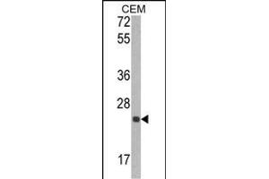 Western blot analysis of TI Antibody (N-term) (ABIN390664 and ABIN2840958) in CEM cell line lysates (35 μg/lane). (TIMP1 anticorps  (N-Term))
