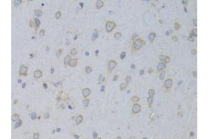 Immunohistochemistry of paraffin-embedded rat brain using GARS antibody (ABIN5973156) at dilution of 1/100 (40x lens). (GARS anticorps)