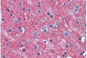 Human Brain, Cortex: Formalin-Fixed, Paraffin-Embedded (FFPE)