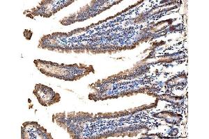 IHC analysis of MSK2/RSK-B/RPS6KA4 using anti-MSK2/RSK-B/RPS6KA4 antibody (ABIN7601238).