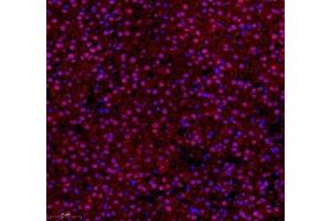 Immunofluorescence of paraffin embedded rat adrenal gland using ZNF295 (ABIN7076264) at dilution of 1: 650 (250x lens)