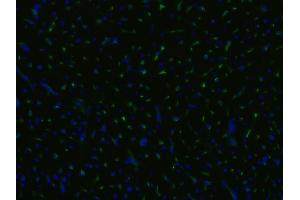 Immunofluorescence staining of an infarcted porcine heart with anti-CD105 (MEM-229 ;