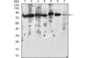 Western blot analysis using RPS6KA2 mouse mAb against Hela (1), A431 (2), HEK293 (3), Jurkat (4), HepG2 (5), MCF-7 (6), NIH/3T3 (7) cell lysate.