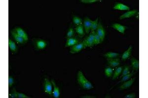 Immunofluorescent analysis of Hela cells using ABIN7154376 at dilution of 1:100 and Alexa Fluor 488-congugated AffiniPure Goat Anti-Rabbit IgG(H+L)