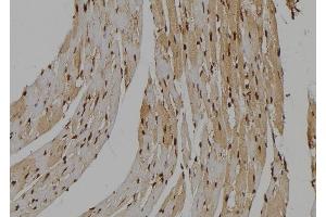 ABIN6263656 and ABIN6277487 at 1/100 staining Mouse heart tissue by IHC-P. (Nemo-Like Kinase anticorps  (N-Term))