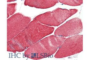 ABIN334386 (5µg/ml) staining of paraffin embedded Human Skeletal Muscle.