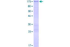 Image no. 1 for Valyl-tRNA Synthetase (VARS) (AA 1-1264) protein (GST tag) (ABIN1324911)