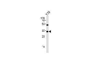 Western blot analysis of lysate from Y79 cell line, using OTX2 Antibody (Center) (ABIN6243699 and ABIN6577613). (OTX2 anticorps  (AA 102-135))