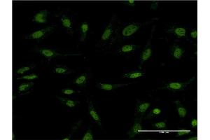 Immunofluorescence of monoclonal antibody to DIDO1 on HeLa cell. (DIDO1 anticorps  (AA 321-420))