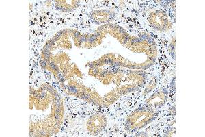 IHC analysis of PDK1 using anti-PDK1 antibody (ABIN5692784).