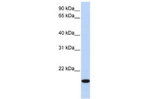 EVX2 antibody used at 0.