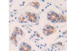 IHC-P analysis of Human Tissue, with DAB staining. (DBR1 anticorps  (AA 243-372))