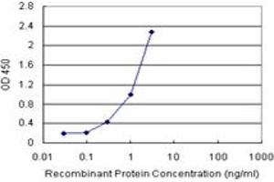 Sandwich ELISA detection sensitivity ranging from 0. (NNMT (Humain) Matched Antibody Pair)