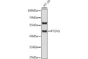 Western blot analysis of extracts of HT-29 cells, using PTOV1 antibody (ABIN7269578) at 1:1000 dilution. (PTOV1 anticorps  (AA 1-100))