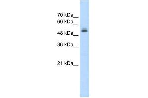 WB Suggested Anti-PRPF19 Antibody Titration:  1. (PRP19 anticorps  (N-Term))