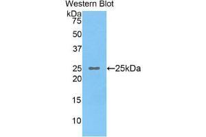 Western Blotting (WB) image for anti-Osteoclast Stimulating Factor 1 (OSTF1) (AA 12-214) antibody (ABIN1860106) (OSTF1 anticorps  (AA 12-214))
