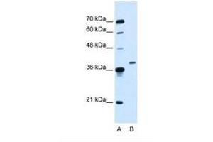 Image no. 1 for anti-Homeobox D11 (HOXD11) (AA 177-226) antibody (ABIN6737663) (HOXD11 anticorps  (AA 177-226))