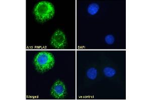 ABIN361184 Immunofluorescence analysis of paraformaldehyde fixed HepG2 cells, permeabilized with 0.