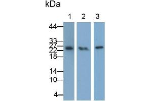 Western Blot; Samples: Lane 1: Mouse Placenta lysate; Lane 2: Rat Placenta lysate; Lane 3: Hela cell lysate; Primary Ab: 0.