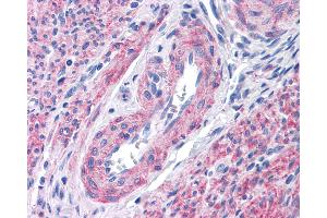 Anti-FFAR1 / GPR40 antibody IHC of human uterus.