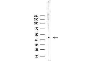 anti-Cyclin-Dependent Kinase 15 (ALS2CR7) (Internal Region) antibody