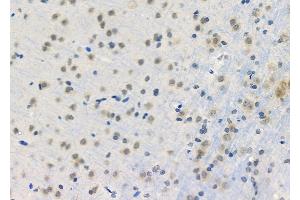 ABIN6262175 and ABIN6274014 at 1/100 staining Rat brain tissue by IHC-P.