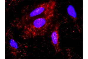 Proximity Ligation Analysis of protein-protein interactions between FYN and CTNNB1.