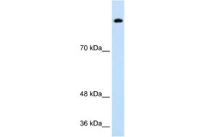 WB Suggested Anti-SREBF1 Antibody Titration:  0. (SREBF1 anticorps  (Middle Region))