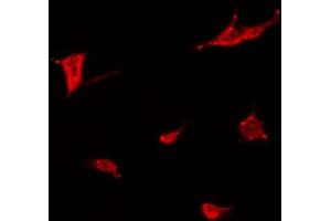 ABIN6266806 staining COLO205 by IF/ICC. (Meningioma 1 anticorps  (Internal Region))