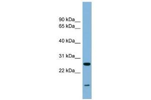 TRAPPC4 antibody used at 0. (TRAPPC4 anticorps  (Middle Region))
